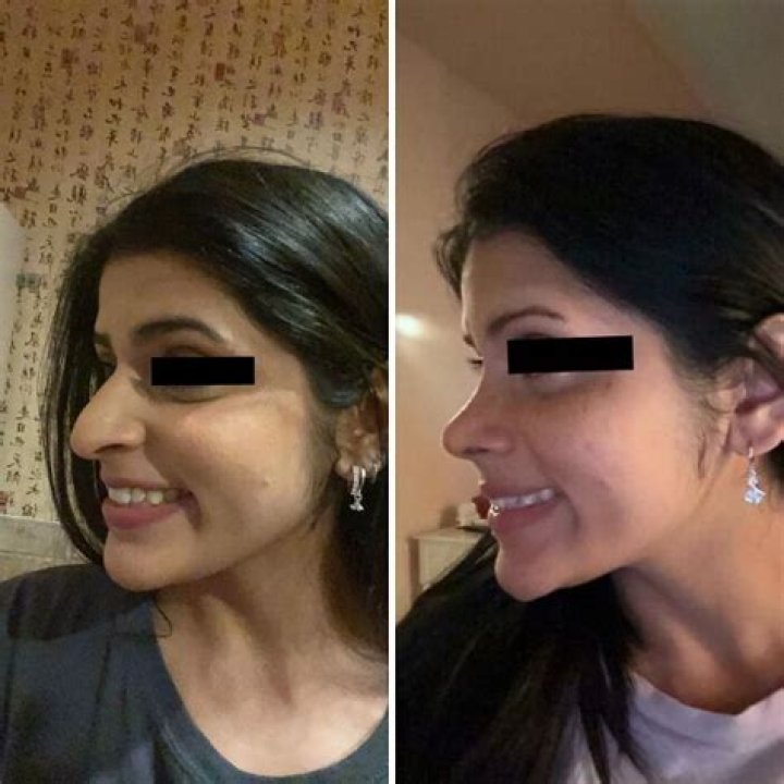 121609_plastic_surgery_housewife_life_and_style_544 121609_plastic_surgery_housewife_life_and_style_544
