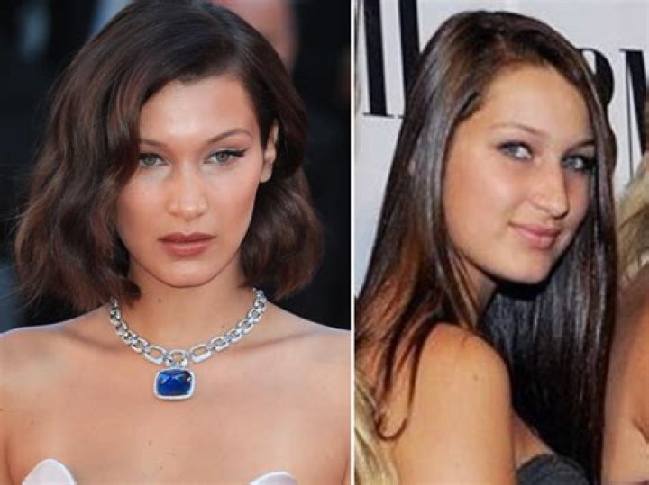 Bella Hadid Before/After