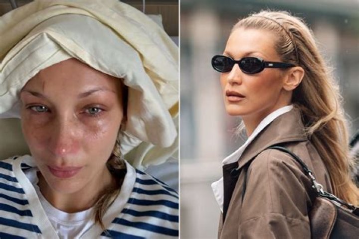 Bella Hadid steps out in Miami in a pair of Dr.Martens boots and a summer dress with friend Hailey Baldwin. The models headed to popular Yardbird for some southern style cooking. Baldwin showed off her long legs and toned stomach in a pair of daisy dukes denim shorts and a crop top.Pictured: Hailey BaldwinRef: SPL1686468 300418 Picture by: Splash NewsSplash News and PicturesLos Angeles:310-821-2666New York:212-619-2666London: