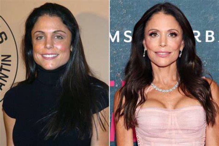 Bethenny Frankel looks amazing in a black and white floral one-piece swimsuit as she goes for a solo stroll on the beach in Miami. 20 Jun 2022 Pictured: Bethenny Frankel. Photo credit: MEGA TheMegaAgency.com +1 888 505 6342 (Mega Agency TagID: MEGA870389_009.jpg) [Photo via Mega Agency]