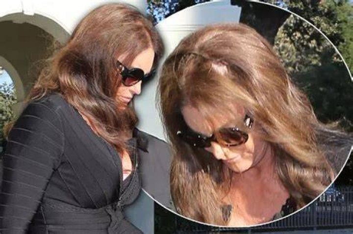 Caitlyn Jenner Hair Malfunction