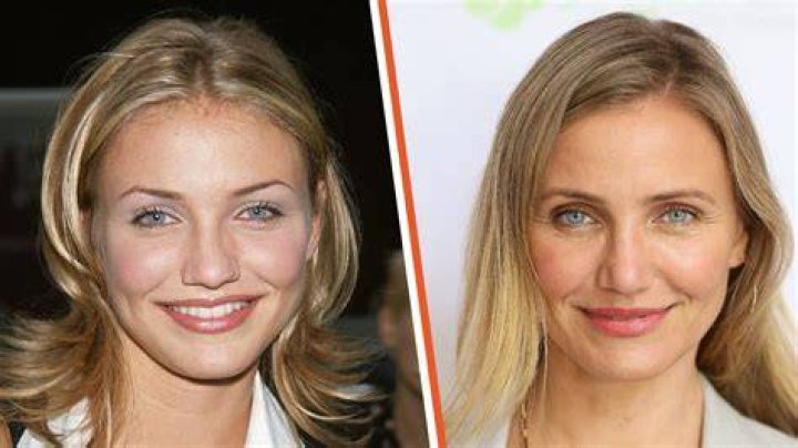 Cameron Diaz Plastic Surgery