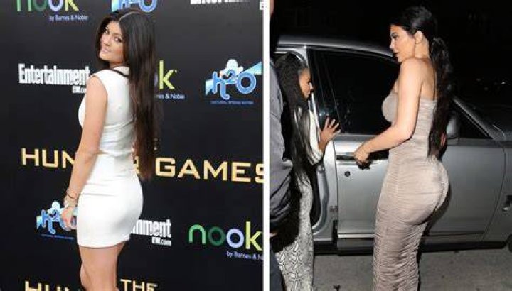 Does Kylie Jenner Have Butt Implants?
