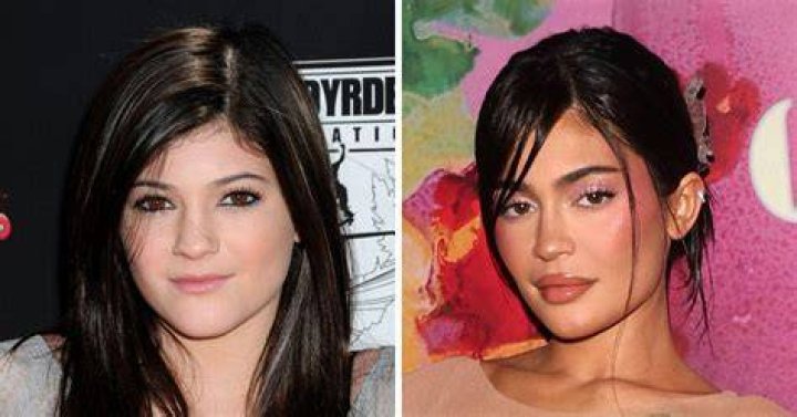 Has Kylie Jenner had a Breast Augmentation?