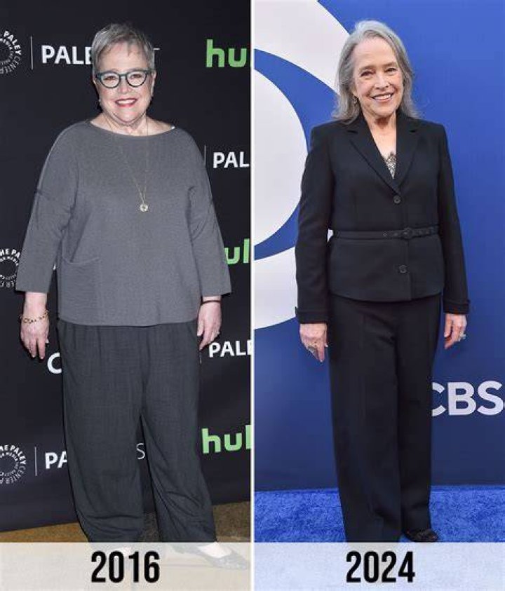 Kathy Bates weight loss transformation