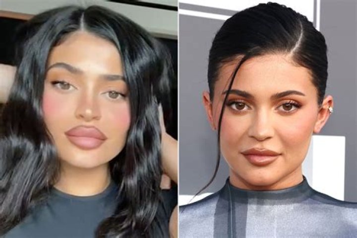 Kylie Jenner&rsquo;s Lips
