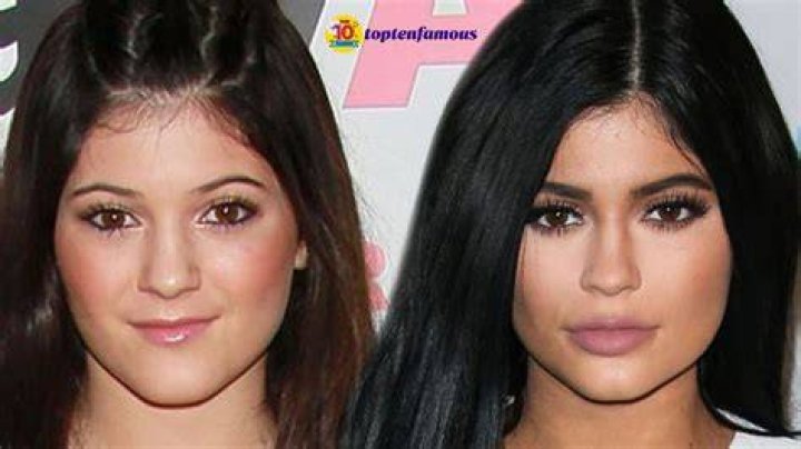 Kylie Jenner Then & Now