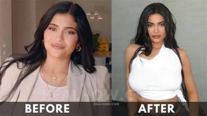 Kylie Jenner Weight Loss