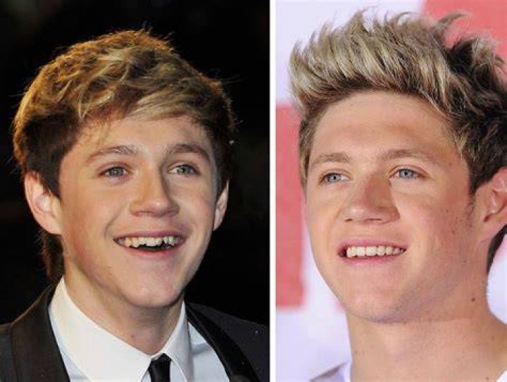 One Direction Makeovers