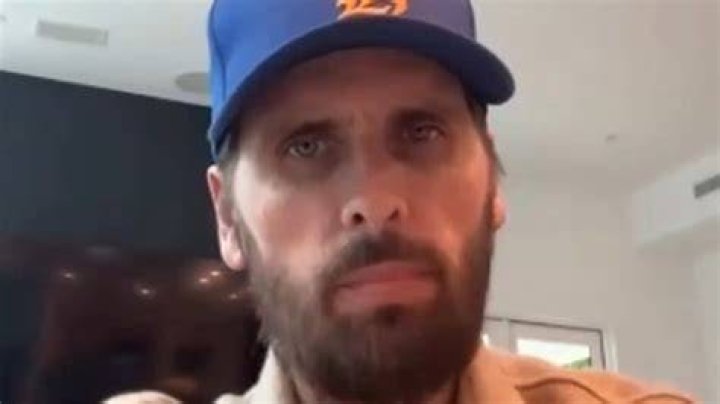 Scott Disick Injured Eye