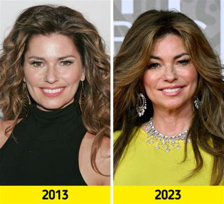 Shania-Twain-face-change