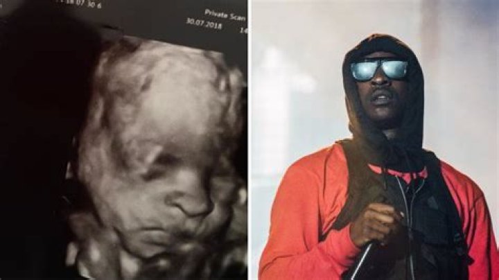 skepta sonogram