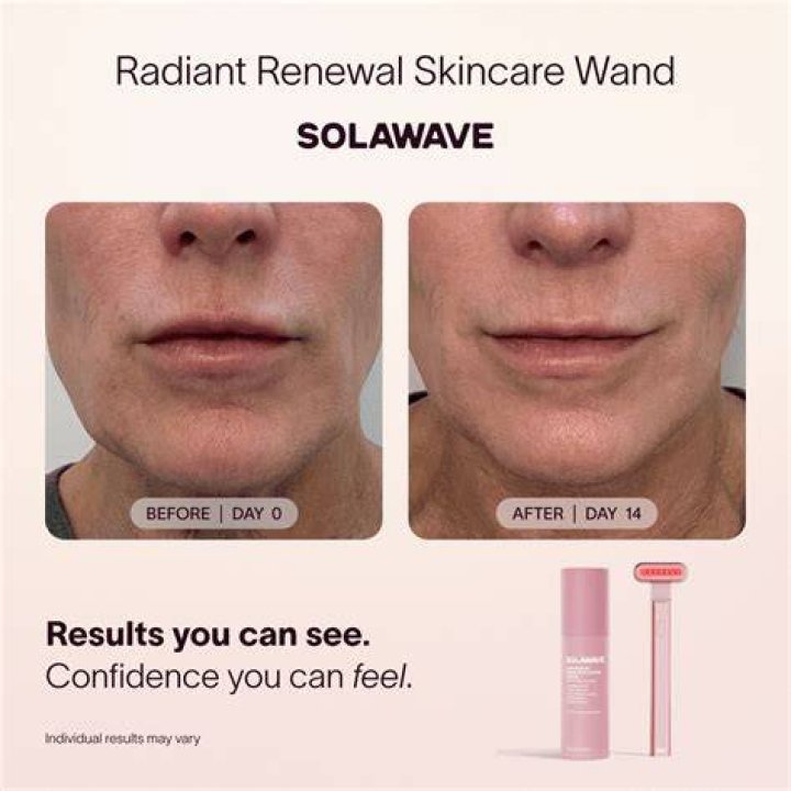 solawave wand