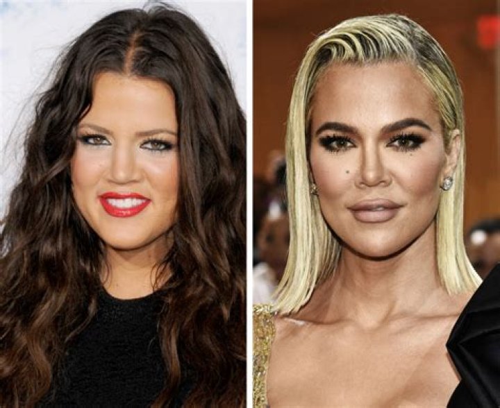 Stars Who Had Extreme Makeovers
