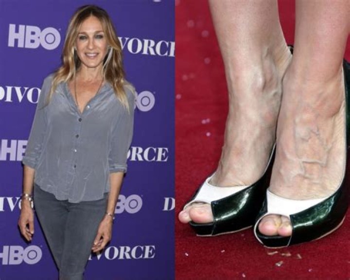 Stars With Freaky Feet & Toes