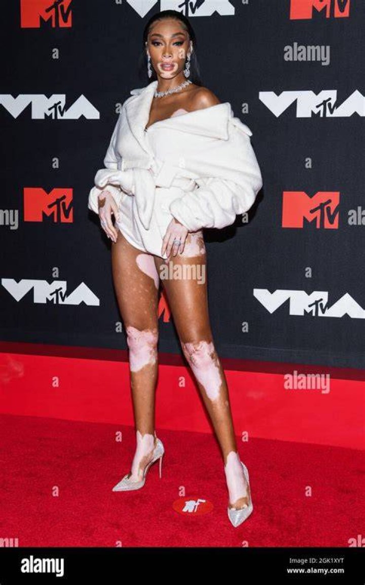 Winnie-Harlow-mtv-video-music-awards-2016-best-dressed