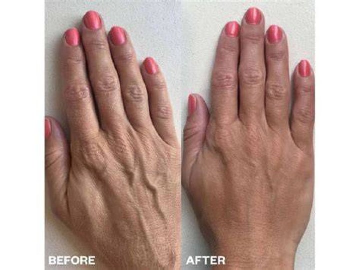Wrinkles Schminkles Hand Wrinkles Smoothing Kit, $30, Neiman Marcus